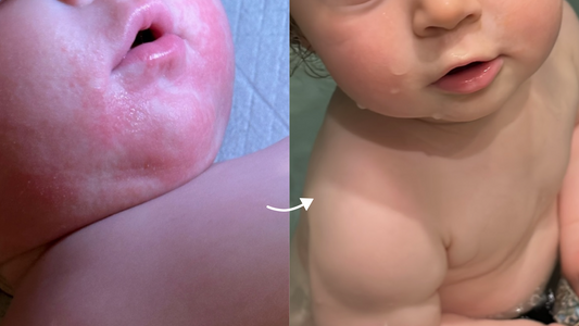 How I healed my daughter’s skin from the inside out